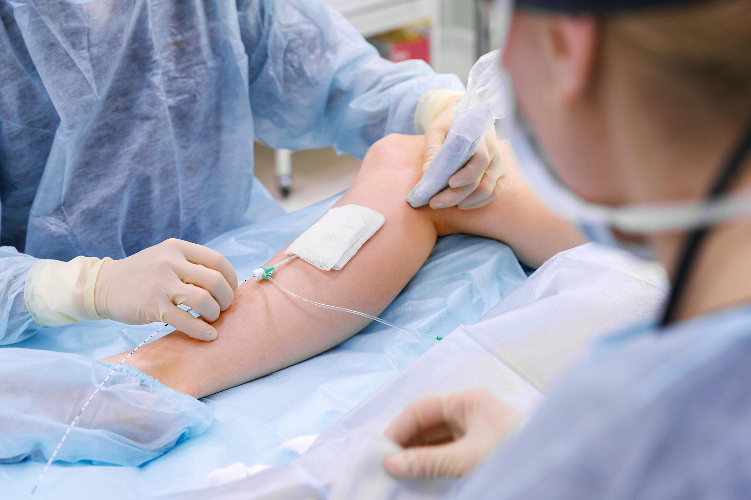 varithena, Varicose veins, Varicose vein treatment, Vein treatment, Vein treatment clinic